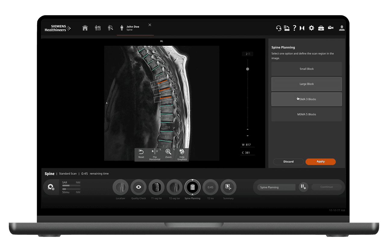 Siemens Healthineers — Spine Planning interface